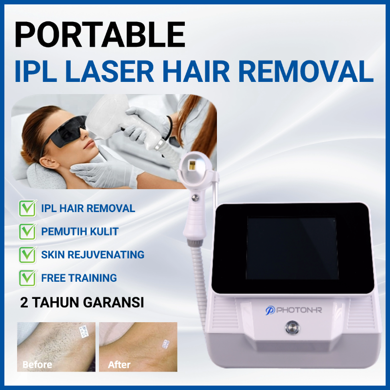 Portable Diode Laser Hair Removal